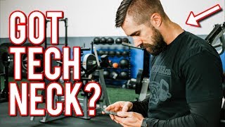 TECHNOLOGY Makes You Ugly (3 Moves to FIX TECH NECK)