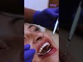 finał uśmiechu ostateczna metamorfoza uśmiechu w dezy dental