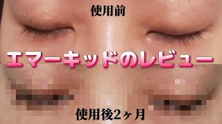 【まつげ美容液】エマーキッドを2ヶ月使った結果【EMAKED】