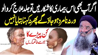 Kan Pairhay Mumps Ka Alamat Aur Ilaj | How Mumps Effect Hearing | Dr Sharafat Ali