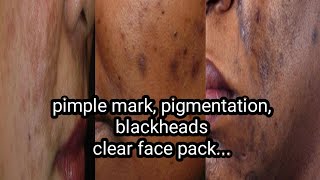 #cinnamonpack  pigmentation,pimples mark, blackheads,unevenskin tone,fair skin cinnamon face pack...