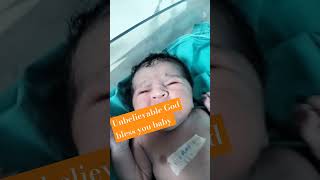 Newborn baby just after birth first calling maa.🐥🎂🤱🤱💐🫡