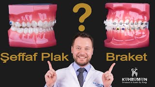 Invisalign Şeffaf Plak Ortodontik Tedavisi ile Braket ( Diş teli ) Karşılaştırması