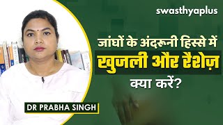 जांघों में रैशेज़ | Heat Rashes/ Jock Itch in Hindi | Symptoms \u0026 Prevention | Dr Prabha Singh