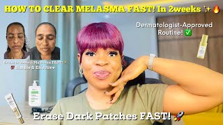 How To CLEAR Melasma FAST & PERMANENTLY 🔥 | Best Pigmentation Treatment On Face + Melasma Skincare✨