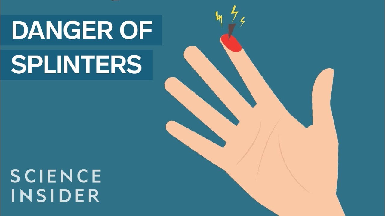Bad Splinters