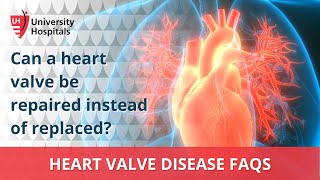 Can a heart valve be repaired instead of replaced?