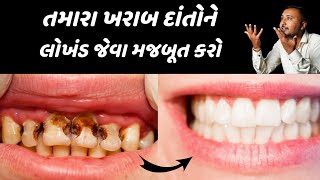 તમારા ખરાબ દાંતોને લોખંડ જેવા મજબૂત કરો | dental cleaning