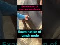 examination of mucous membranes l examination of lymph nodes l dr umar khan