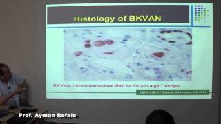 3rd esnt BK nephropathy Prof Ayman Refaie