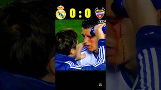 Ronaldo Revenge| The Day Ronaldo Crash His Eye #ronaldo #football #shortsvideo #shorts