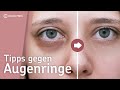 3 Tipps gegen Augenringe | Ursachen eines Eisenmangels