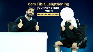 8cm Tibia Lengthening  journey Start With Heightincreaseinfo