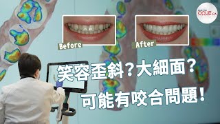 牙齒解密 EP3｜笑容歪斜？大細面？你的牙齒可能有咬合問題！(ALFIE Dentistry) #多倫多生活 #牙齒 #牙醫 #北約克 #多倫多