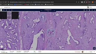 PRAID AI: Complete Histopathology Annotation Workflow (End-to-End Demo)