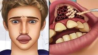 ASMR Remove botfly maggots found insidemountaineer's mouth | Dental care animation