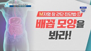 [기분 좋은 날] 전신 건강 위협하는 M자형 장 '배꼽 모양'으로 진단하라 20200218