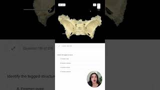 Cadaveric Anatomy of the Sphenoid Bone