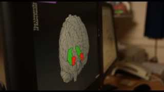 Inside the brain of someone suffering with depression