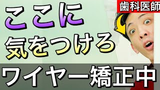 【ワイヤー矯正を成功させるために】あなたが気をつけるべきポイント