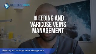 What to do when varicose veins bleed