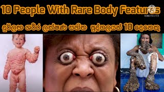 10 People With Rare Body Features - ලෝකයේ දුර්ලභම ශරීර සහිත පුද්ගලයන් 10 දෙනෙකු සිංහල උපසිරැසි සමඟ