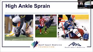 Management & Treatment of Ankle Sprains & Tendinopathy
