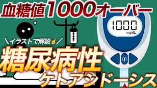 糖尿病性ケトアシドーシスによる昏睡は治る？救急搬送された時の初期治療と看護について