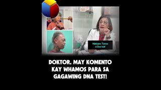 Pahayag ng Doktor sa nais gawing DNA test ni Whamos, Viral