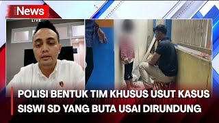 Reskrim Polres Gresik Bentuk Tim Khusus, Ungkap Kasus Siswi SD Buta Dicolok Tusuk Bakso