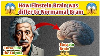 How Albert Einstein's  brain was different to other humans | Einstein's brain