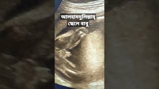 আলহামদুলিল্লাহ আলট্রাতে ছেলে বাবু: ডাঃ নূসরাত ইসলাম #pregnancy #ultrasonogram USG of Male baby