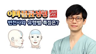 이마성형, 본시멘트의 장점과 다른 보형물의 한계점은?