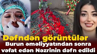 Burun əməliyyatından sonra komaya düşüb vəfat edən Nəzrin Mansurova dəfn edildi