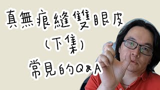 真無痕縫雙眼皮常見問題～沈筠惇 #縫雙眼皮 #真無痕逢雙眼皮