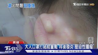 7歲女童戴大人口罩 耳後發炎長「壓迫性腫瘤」｜TVBS新聞