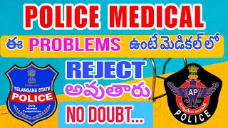 పోలీస్ కానిస్టేబుల్ మెడికల్ టెస్ట్ ఎలా చేస్తారు|ap police constable latest news#appolice#medicaltest