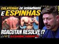 ROACUTAN e TRATAMENTOS de ACNE ! COMO ELIMINAR as ESPINHAS !? | ALEXANDRE ZAMBROTTA