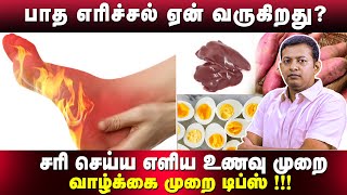 கால் பாத எரிச்சல் ஏன் வருகிறது?சரி செய்ய எளிய உணவு முறை / வாழ்க்கை முறை டிப்ஸ் !!! | Dr. Arunkumar