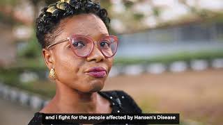 Experience: Life with leprosy in Nigeria