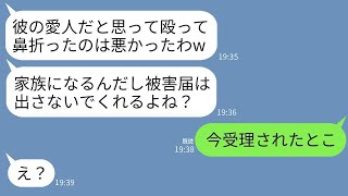 兄の結婚式前日、家に遊びに行った妹の私を殴って鼻を折った兄の婚約者「泥棒猫と勘違いしちゃったw」→被害届は出すなと迫る女に真実を伝えた結果www