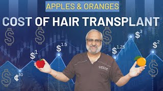 Hair Transplant Cost in India: The TRUTH !