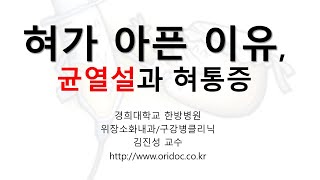 혀 갈라짐 원인, 균열설. 혓바닥 갈라짐; 타액분비 감소  및 혀조직의  탄력 저하