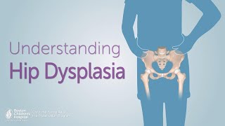 Understanding Hip Dysplasia | Boston Children's Hospital