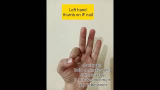 ಬೆನ್ನು ನೋವಿಗೆ ಮುದ್ರೆ | Mudra for Back Pain