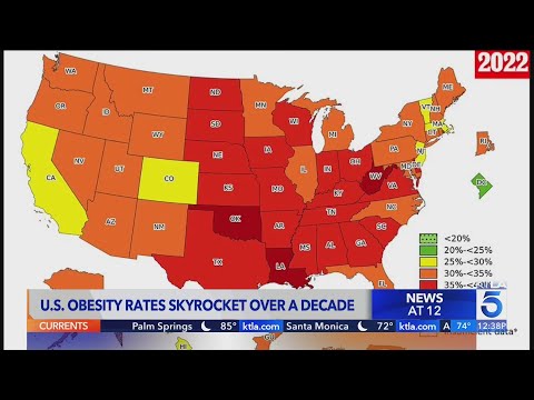 What is the prevalence of obesity in the United States?