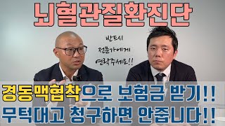 [보리받21] 1/2 뇌혈관질환 진단비 청구, 경동맥 협착이라면 정말 신중하게 알아야 할 것들!!