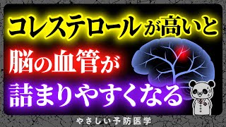 【医師解説】脳の血管を詰まりにくくする食べ物5選