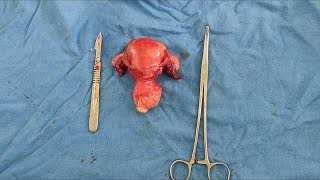 Total Abdominal Hysterectomy (TAH) with Bilateral Salpingo-Oophorectomy (BSO) specimen