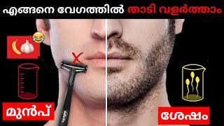 HOW TO GROW A BEARD FAST & NATURALLY || Time For Greatness